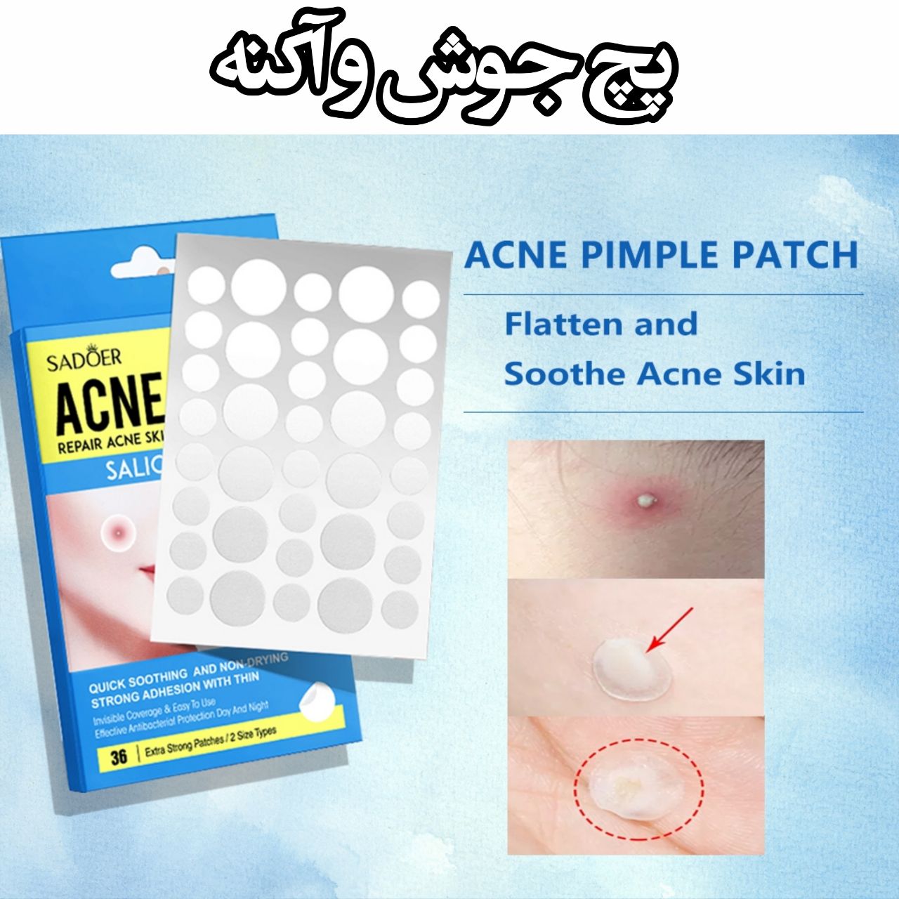 پچ ضدجوش و آکنه کاور کننده و ترمیم کننده و از بین برنده جوش و آکنه Sadoer Acne Patch 36Pic