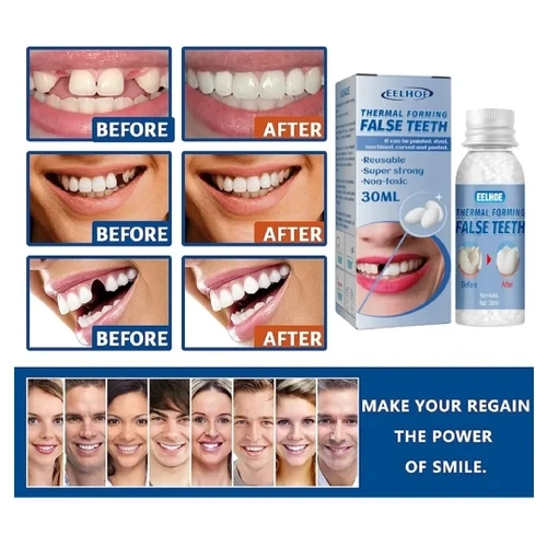 ایمپلنت فوری دندان ( نقد و اقساط ) جای خالی دندانت را خودت پر کن پروتز جادویی TEMPORARY TEETH اصل